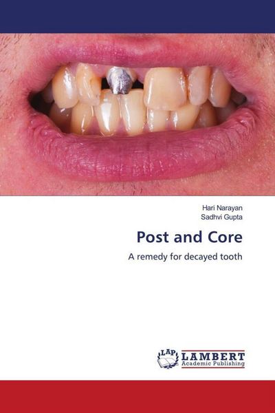 Produktbild: Post and Core