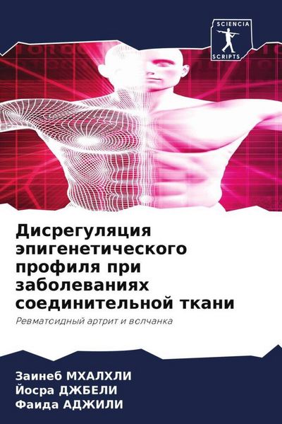 Produktbild: Disregulqciq &auml;pigeneticheskogo profilq pri zabolewaniqh soedinitel'noj tkani