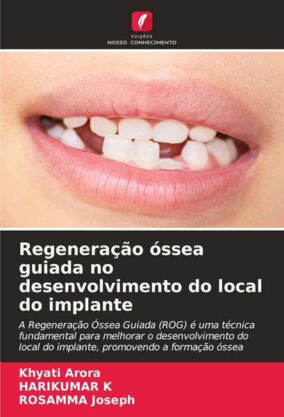 Produktbild: Regenera&ccedil;&atilde;o &oacute;ssea guiada no desenvolvimento do local do implante
