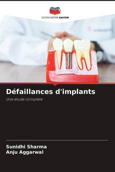 Produktbild: D&eacute;faillances d'implants