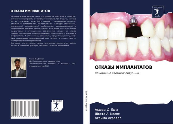 Produktbild: Otkazy Implantatov
