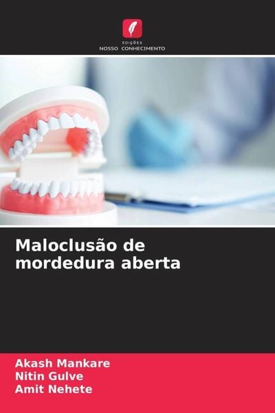 Produktbild: Maloclus&atilde;o de mordedura aberta