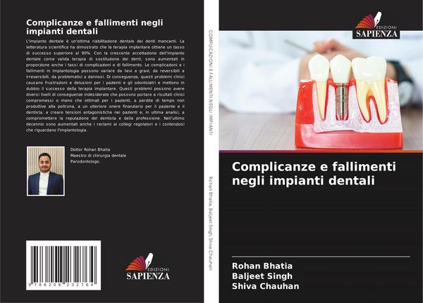 Produktbild: Complicanze e fallimenti negli impianti dentali
