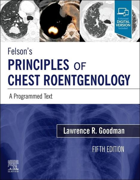 Produktbild: Felson's Principles of Chest Roentgenology, a Programmed Text