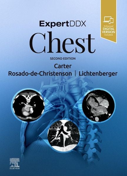 Produktbild: Expertddx: Chest