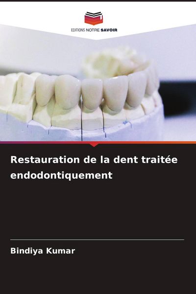Produktbild: Restauration de la dent trait&eacute;e endodontiquement