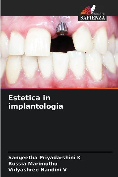 Produktbild: Estetica in implantologia