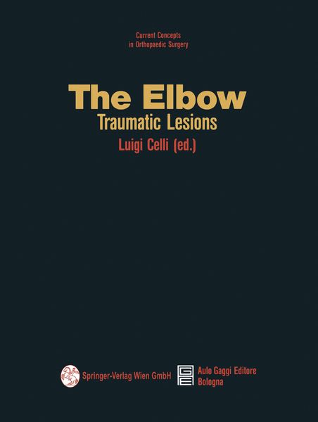 Produktbild: The Elbow