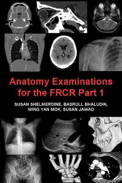 Produktbild: Anatomy Examinations for the FRCR Part 1