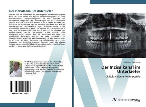 Der Inzisalkanal im Unterkiefer, Taschenbuch von Michael Damouras, AV Akademikerverlag, 9783639678048