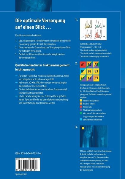Produktbild: Frakturen