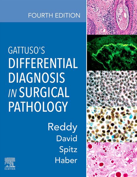 Produktbild: Gattuso's Differential Diagnosis in Surgical Pathology