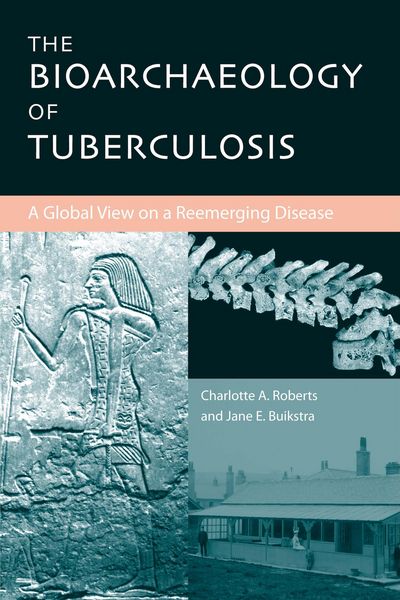 Produktbild: The Bioarchaeology of Tuberculosis