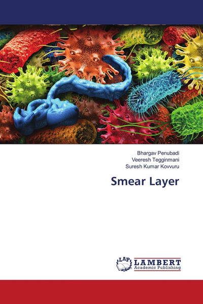 Produktbild: Smear Layer