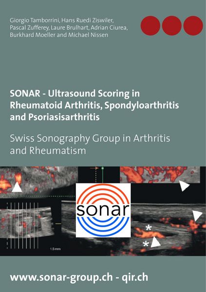 Produktbild: SONAR - Ultrasound Scoring in Rheumatoid Arthritis, Spondyloarthritis and Psoriasisarthritis