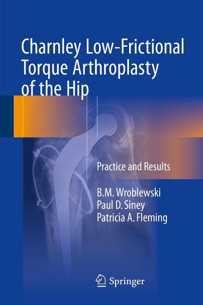 Produktbild: Charnley Low-Frictional Torque Arthroplasty of the Hip