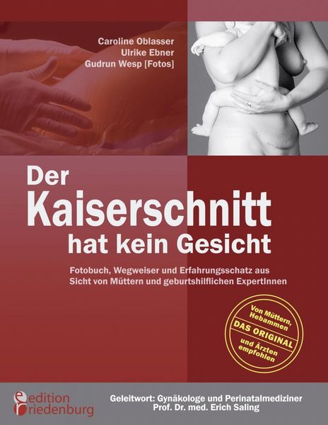 Produktbild: Der Kaiserschnitt hat kein Gesicht - Fotobuch, Wegweiser und Erfahrungsschatz aus Sicht von M&uuml;ttern und geburtshilflichen ExpertInnen