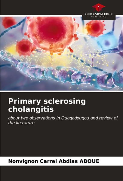 Produktbild: Primary sclerosing cholangitis
