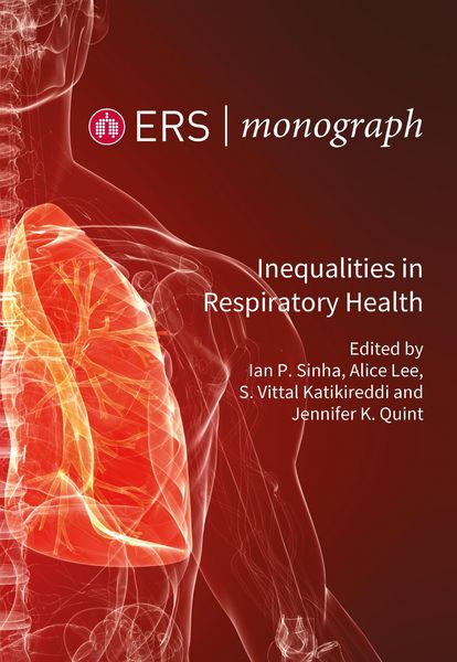 Produktbild: Inequalities in Respiratory Health