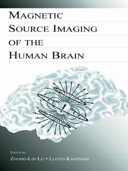 Produktbild: Magnetic Source Imaging of the Human Brain