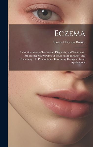 Produktbild: Eczema: A Consideration of Its Course, Diagnosis, and Treatment, Embracing Many Points of Practical Importance, and Containing