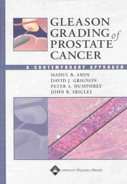 Produktbild: Gleason Grading of Prostate Cancer: A Contemporary Approach