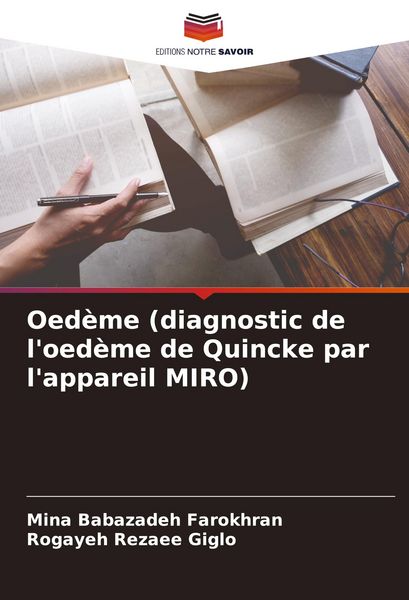 Produktbild: Oed&egrave;me (diagnostic de l'oed&egrave;me de Quincke par l'appareil MIRO)
