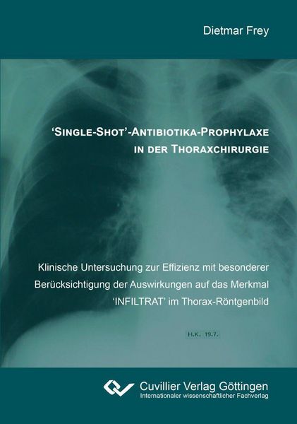 Produktbild: 'Single-Shot'-Antibiotika-Prophylaxe in der Thoraxchirurgie