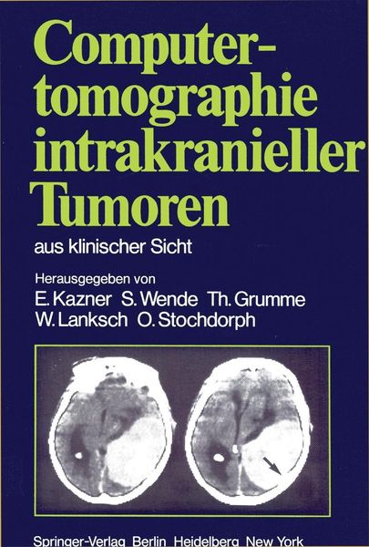 Produktbild: Computertomographie intrakranieller Tumoren aus klinischer Sicht