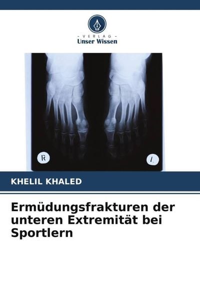 Ermüdungsfrakturen der unteren Extremität bei Sportlern, Taschenbuch von Khelil Khaled, Verlag Unser Wissen, 9786205619742