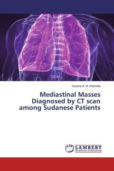 Produktbild: Kheiralla, O: Mediastinal Masses Diagnosed by CT scan among