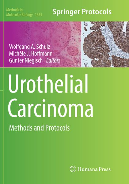 Produktbild: Urothelial Carcinoma