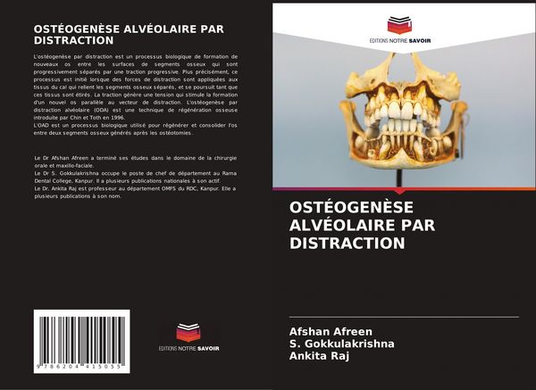 Produktbild: Ost&eacute;ogen&egrave;se Alv&eacute;olaire Par Distraction