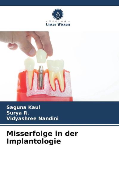 Produktbild: Misserfolge in der Implantologie