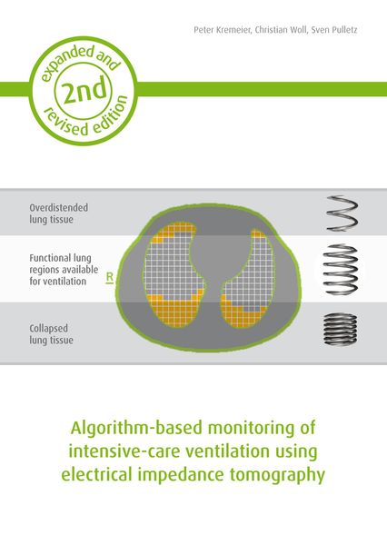 Produktbild: Algorithm-based monitoring of intensive-care ventilation using electrical impedance tomography
