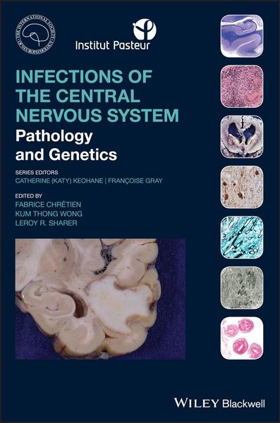 Produktbild: Infections of the Central Nervous System