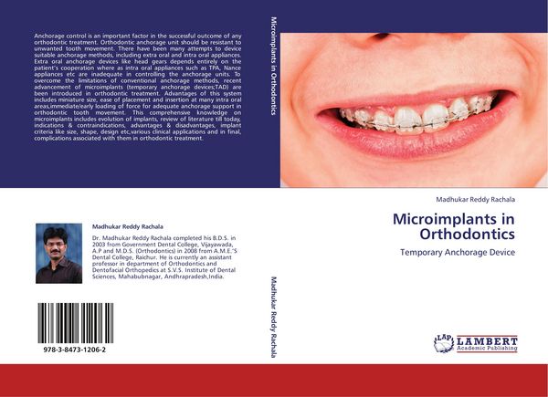 Produktbild: Microimplants in Orthodontics
