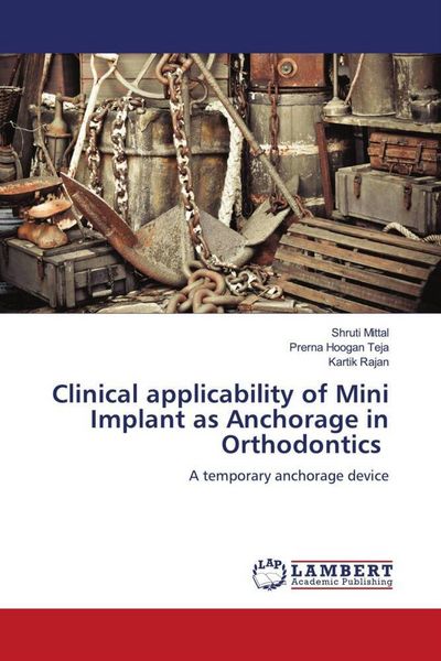 Produktbild: Clinical applicability of Mini Implant as Anchorage in Orthodontics