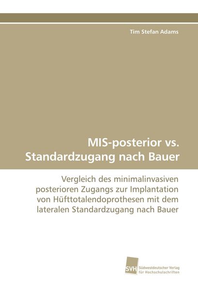 Produktbild: MIS-posterior vs. Standardzugang nach Bauer