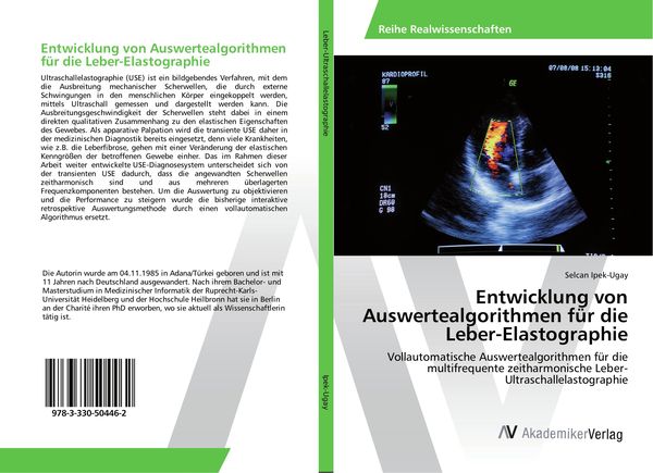 Produktbild: Entwicklung von Auswertealgorithmen f&uuml;r die Leber-Elastographie