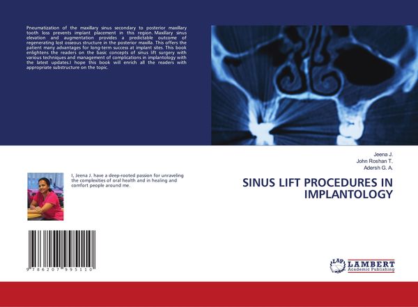Produktbild: SINUS LIFT PROCEDURES IN IMPLANTOLOGY