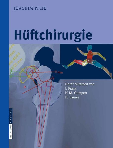 Produktbild: H&uuml;ftchirurgie