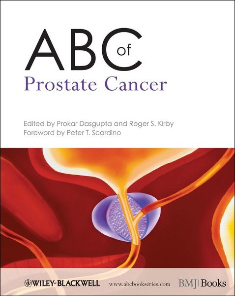 Produktbild: ABC of Prostate Cancer