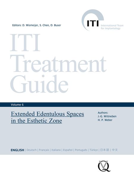 Produktbild: Extended Edentulous Spaces in the Esthetic Zone