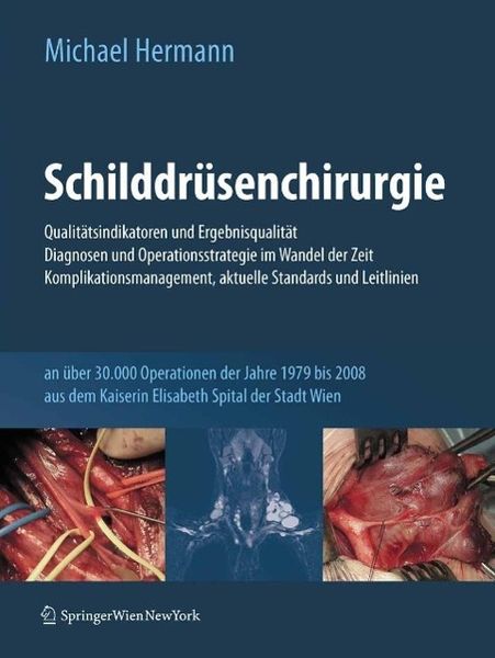 Produktbild: Schilddr&uuml;senchirurgie - Qualit&auml;tsindikatoren und Ergebnisqualit&auml;t, Diagnosen und Operationsstrategie im Wandel der Zeit, Komplikationsmanagement, aktu