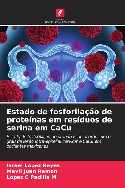 Produktbild: Estado de fosforila&ccedil;&atilde;o de prote&iacute;nas em res&iacute;duos de serina em CaCu