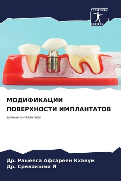 Produktbild: Modifikacii Poverhnosti Implantatov