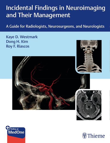 Produktbild: Incidental Findings in Neuroimaging and Their Management