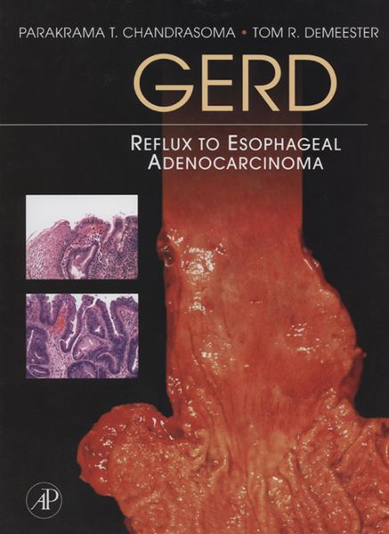 Produktbild: GERD