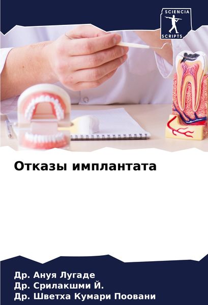 Produktbild: Otkazy implantata